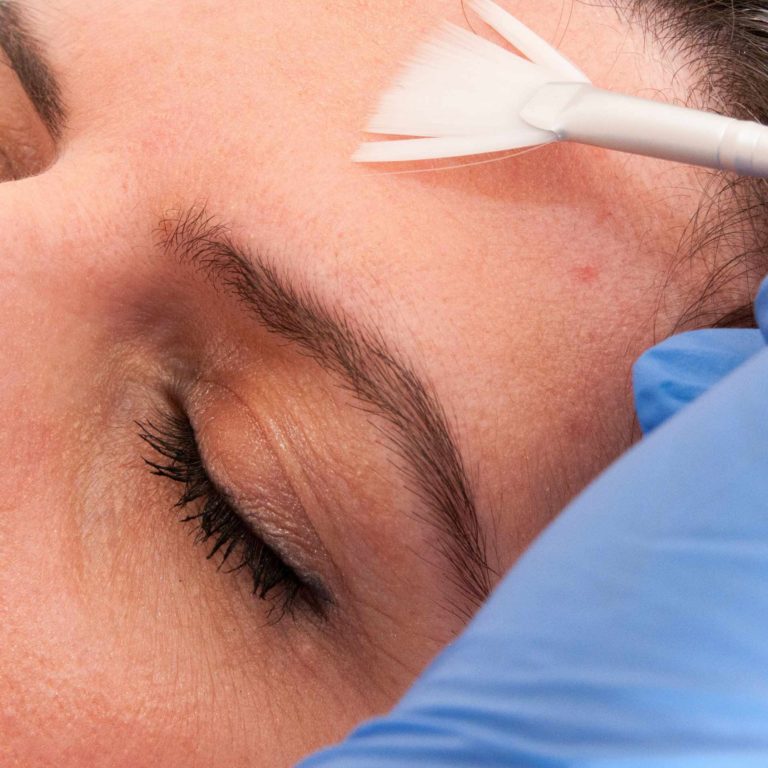 Peeling για λαμπερή επιδερμίδα