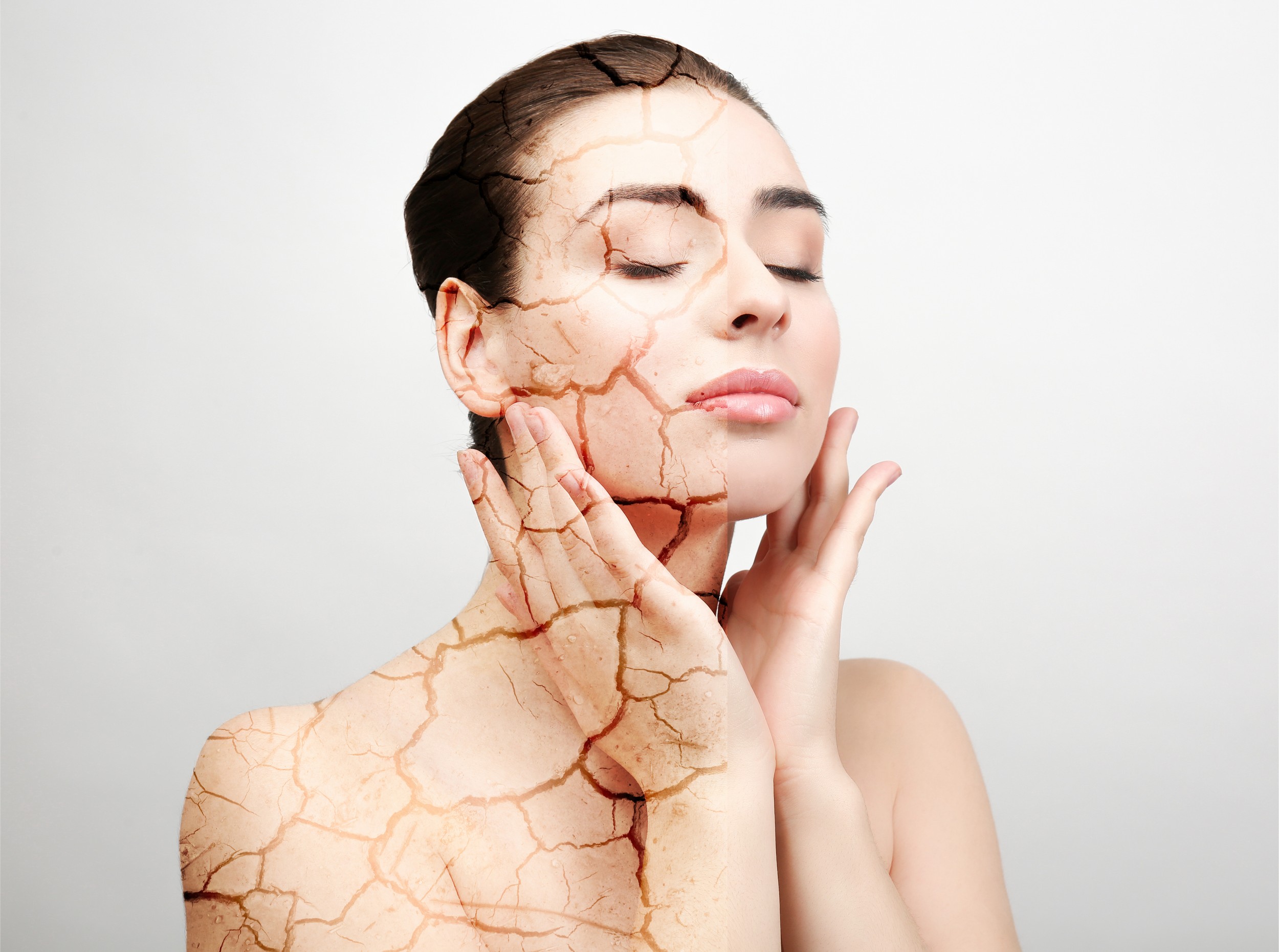 sensitive skin Top 6 συστατικά που δεν χρησιμοποιούν οι άνθρωποι με ευασίσθητο δερμα