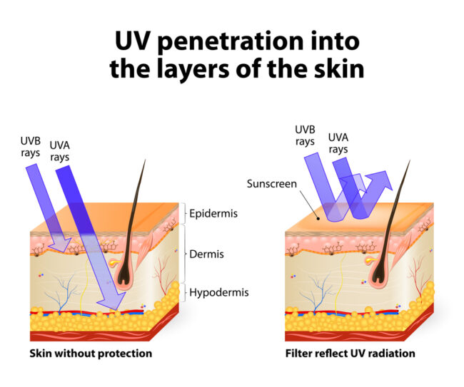 Ευαισθητοποίηση UV Ευαισθητοποίηση UV